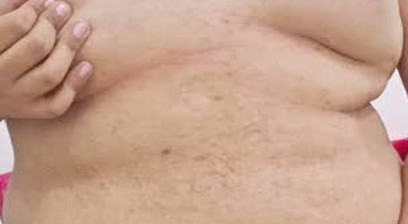 Naked chubby boy tits